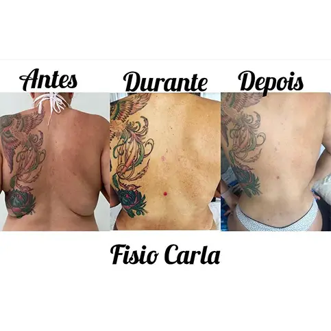 Resultado 1