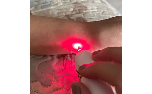 Laserterapia